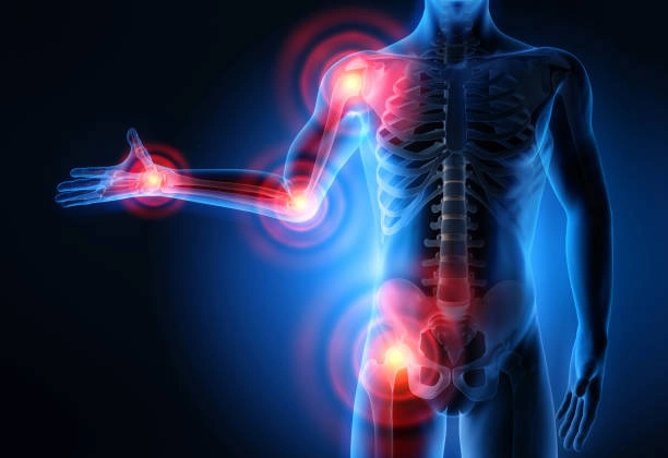 Jarak Bali Untuk Rematik