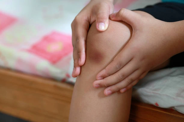 Jarak Bali Untuk Memar