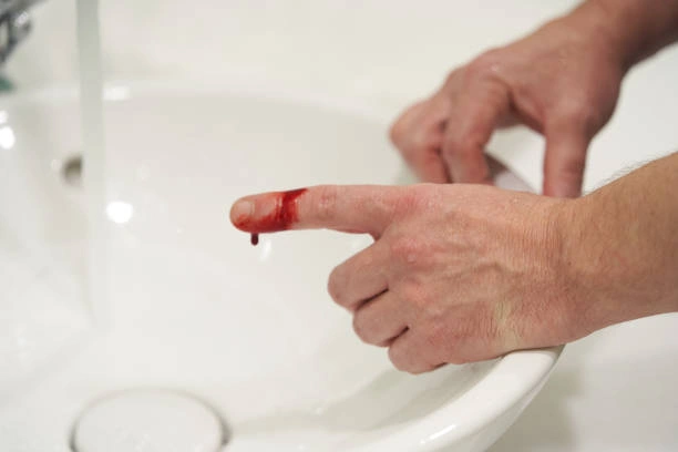 Kayu Secang Untuk Menghentikan Pendarahan