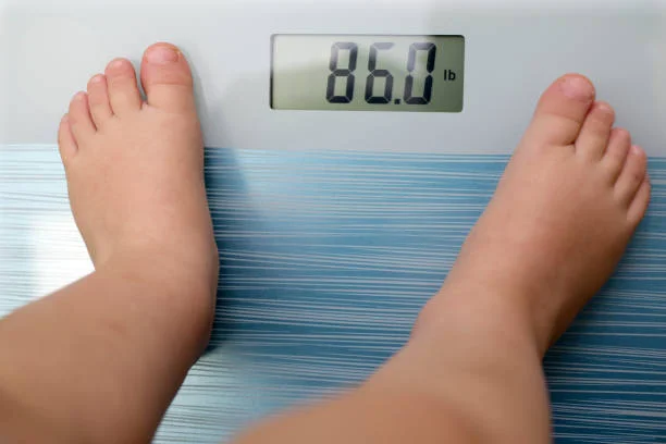 Obesitas pada Anak dan Risiko Kesehatan yang Mengintai