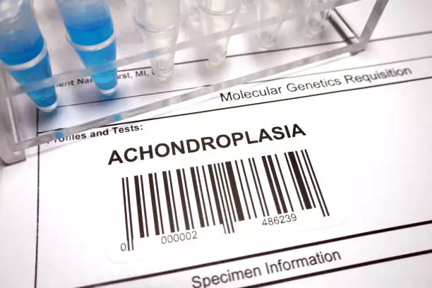 Resep HNI Achondroplasia