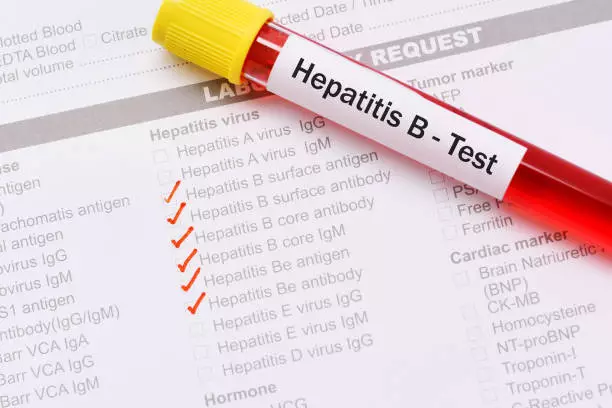 Pengalaman Mengobati Hepatitis B Dengan Cara Alami