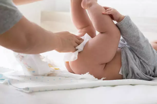 Cara Mengatasi Bayi Susah BAB Hingga 5 Hari Dengan Teknik Ini