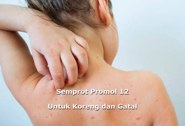 Promol12 Untuk Obati Koreng dan Gatal Anak